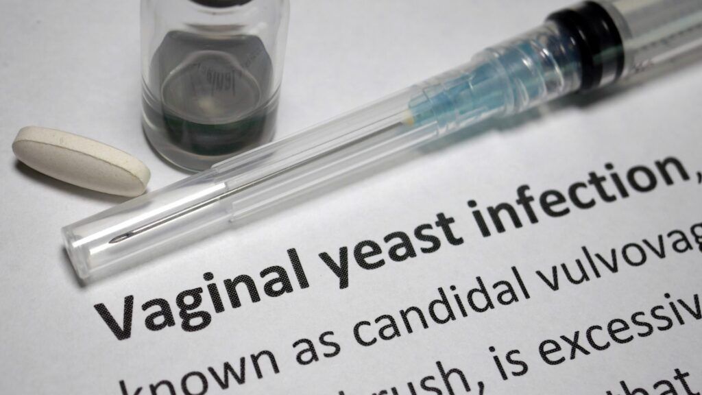 Vaginal Yeast Infection